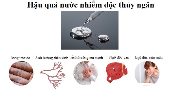 Hậu quả của việc phơi nhiễm thủy ngân