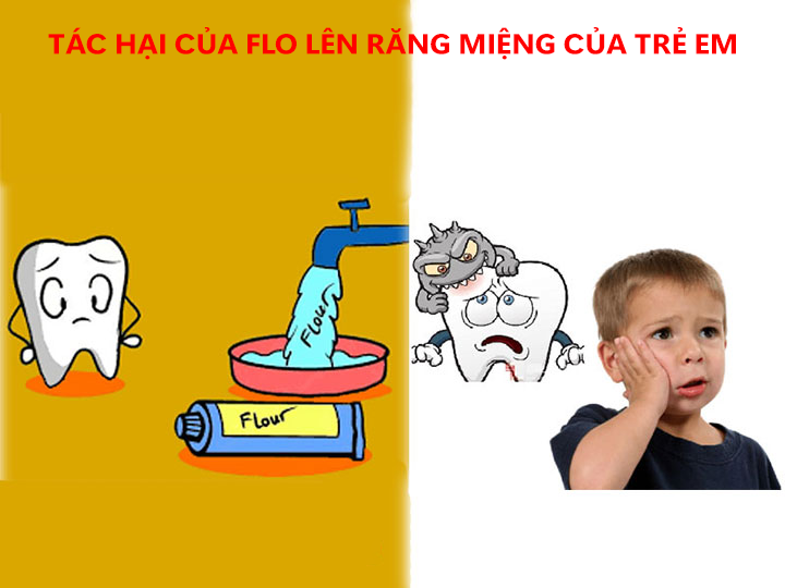 Tác hại của Florua lên hàm răng