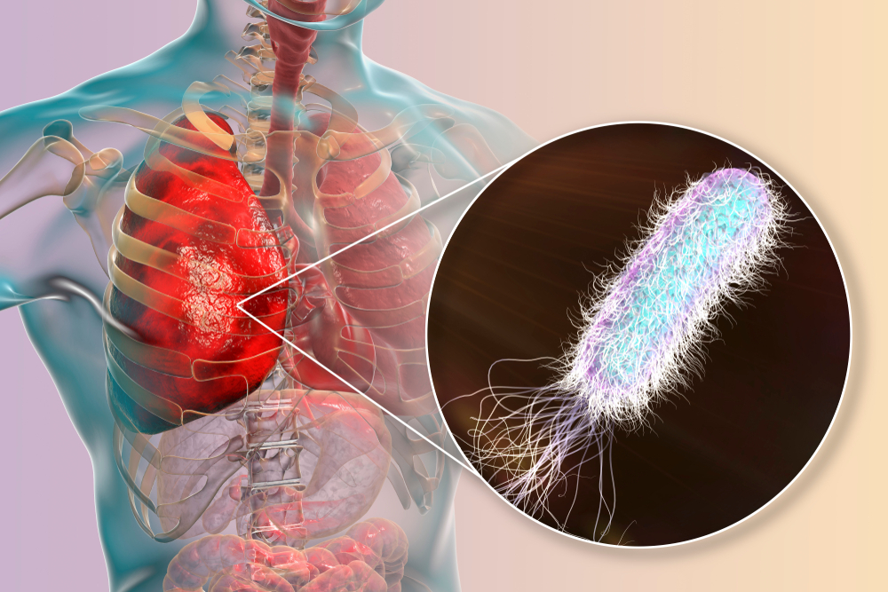 Vi khuẩn Pseudomonas aeruginosa trong nước uống – Nguy cơ sức khỏe & cách xử lý
